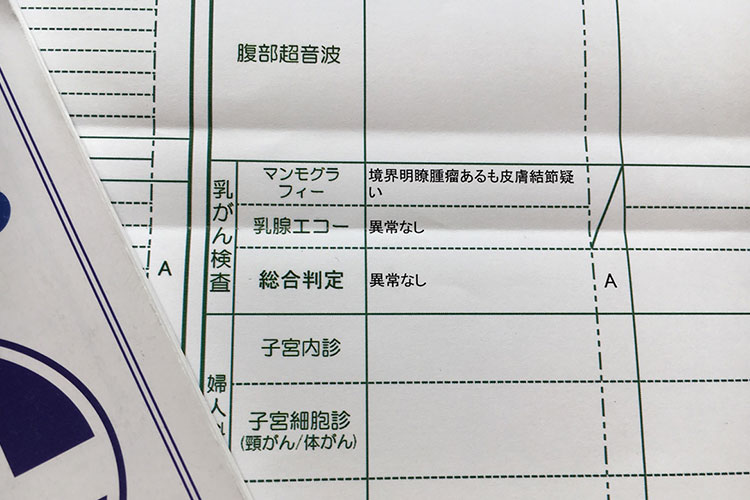 画像検査・精密検査画像