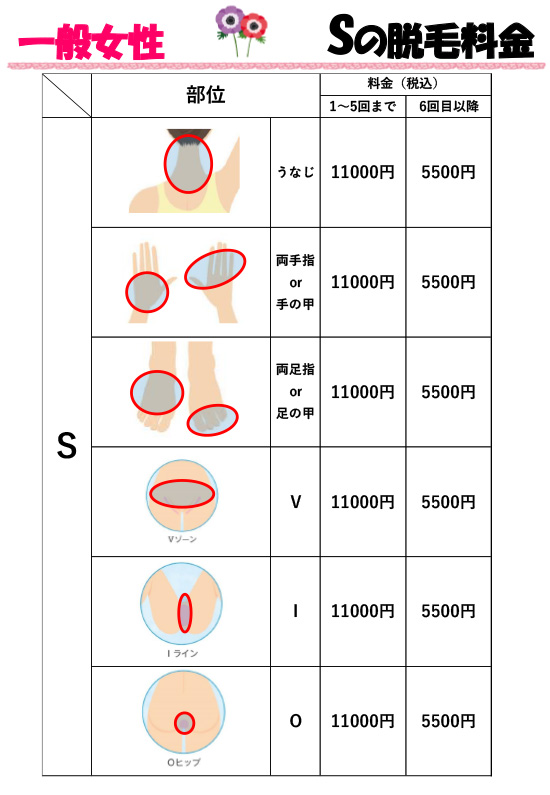 一般女性料金表 Sの脱毛料金